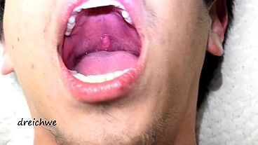 Deep uvula