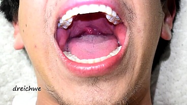 Deep uvula