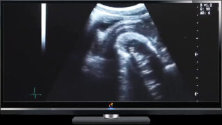 Couple, bareback, cocks, doctor, medical &#8211; guys with big dicks fucking in the ass