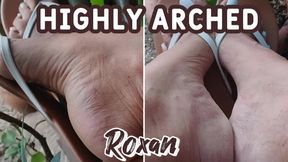 What magnificent pronounced arches on the feet of a woman in flip flops (3)