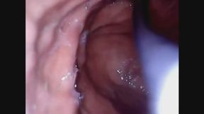 Bailey's Pineapple (STOMACH FOOTAGE)