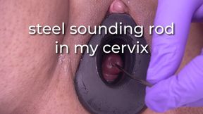 steel sounding rod in my cervix