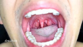 large uvula and hot