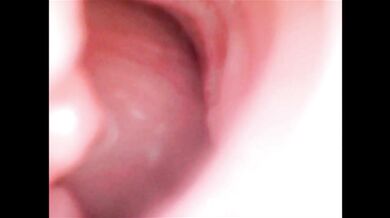 Endoscope deep inside wet pussy gets creampie cumshot