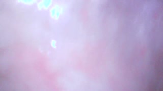 Gaping cunt and cervix show
