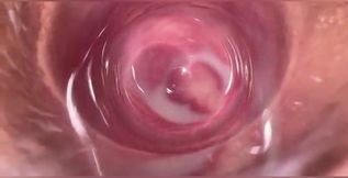 Camera in Vagina, Cervix POV, Creampie