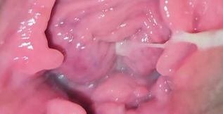 Camera in Vagina, Cervix POV, Creampie
