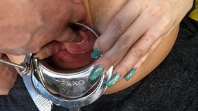 Cervix fingering
