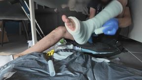 Short Leg Cast Application - SLC - Platre jambe - Résine - Cast Fetish