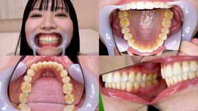 Kanon Mashiro - Watching Inside mouth of Japanese cute girl - 1080p