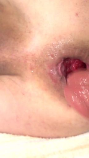 My Foreskin Penis and Loose Asshole 2026 #07