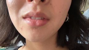 Aurora’s Teeth Get A New Look