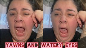 Yawns and watery eyes