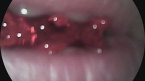 Vore endoscope #5 red gummy bear !!