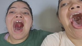 Campaigns in action, open mouths! Uvula