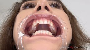 Inside My Mouth - Yulia - Mouth retractor clip! (4K quality)