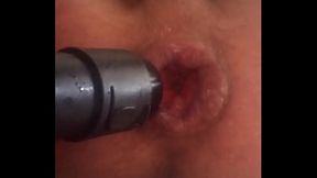 my big anal lips get sucked in by a vacuum cleaner while i jerkoff my prolapse