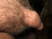My hairy tiny dick with one testicle