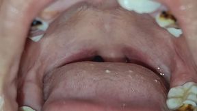 What no one showed you about 'ugly' teeth... until today.”