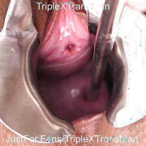 Extreme Cervix Penetration, Sounds, Speculum, Uterus Dilation