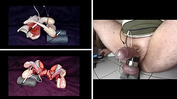 electrical stimulation of the testicles