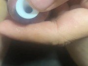 尿道异物插入