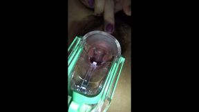 Vaginal Observation Video 1