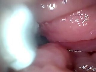 Semen in Cervix Wide Stretching Pussy Endoscope!