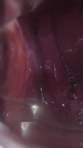 Cum Cervix Insemination