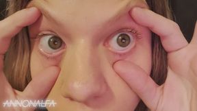 Hazel Eye Check (reupload)