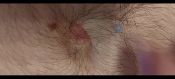 A Close-up Shot of My Belly Button as I Play with It