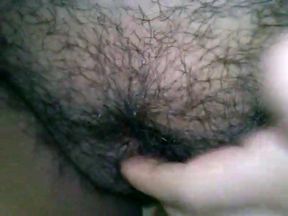 My hairy