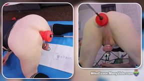 Fabulous fucking machine anal dildo fucking in chastity cage