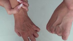 LARGE VEINS ON THE ARMS Ec