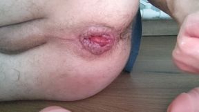 Anal Part 1