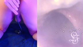 deepest anal exploration ever!