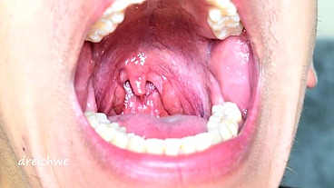 Uvula in the foreground - Collection 12