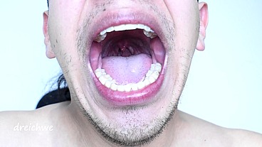 Úvula con saliva