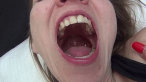 M HORRIBLE MORNING BAD BREATH 4Y