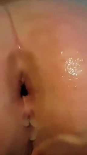 Extreme Anal Fisting, Gaping and Huge Rosebudprolapse