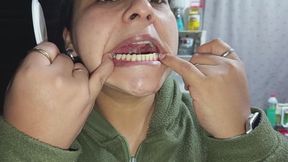 Limpieza de dientes, sacando manchas y sarros. Fantasía de odontóloga.