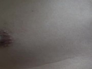 hair removal arround nipples