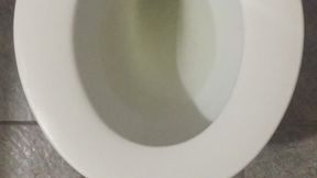 MY PEE IS GOLD