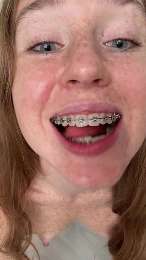 Teen GF shows off her braces and more