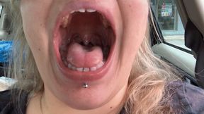 Post Dentist Mouth Tour with Novocaine 1080p mp4