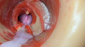 Female Insemination - Internal Camera Captures Deep Male Huge Ejaculation