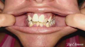 Showing you my teeth in the morning (close-up). Unbrushed teeth in the morning. Dirty natural teeth. (Video without audio)