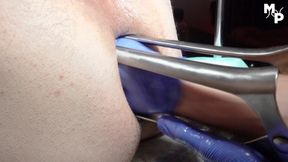 Enormous anal stretching