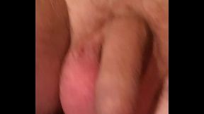 My micro penis