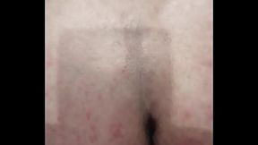 Anal 34